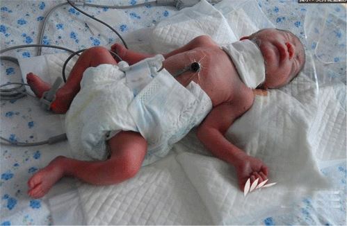 玛丽亚妇产医院 【新闻聚焦】辽宁鞍山新生女婴遭割喉被遗弃后续热议点评