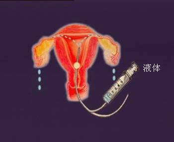 ѹܻˮ